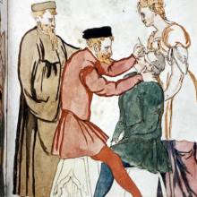 Medieval eye surgery